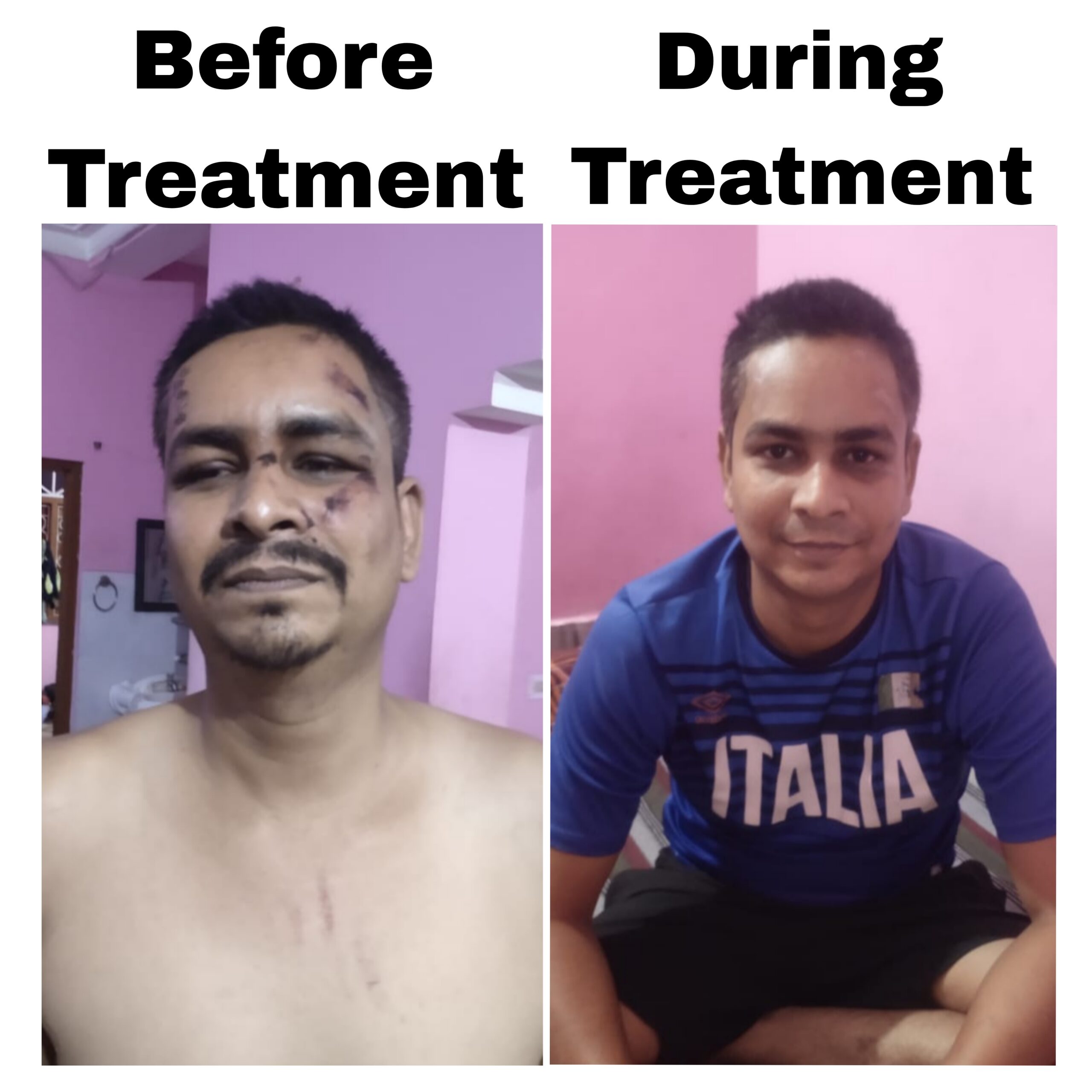 {"remix_data":[],"remix_entry_point":"challenges","source_tags":[],"origin":"unknown","total_draw_time":0,"total_draw_actions":0,"layers_used":0,"brushes_used":0,"photos_added":0,"total_editor_actions":{},"tools_used":{},"is_sticker":false,"edited_since_last_sticker_save":false,"containsFTESticker":false}